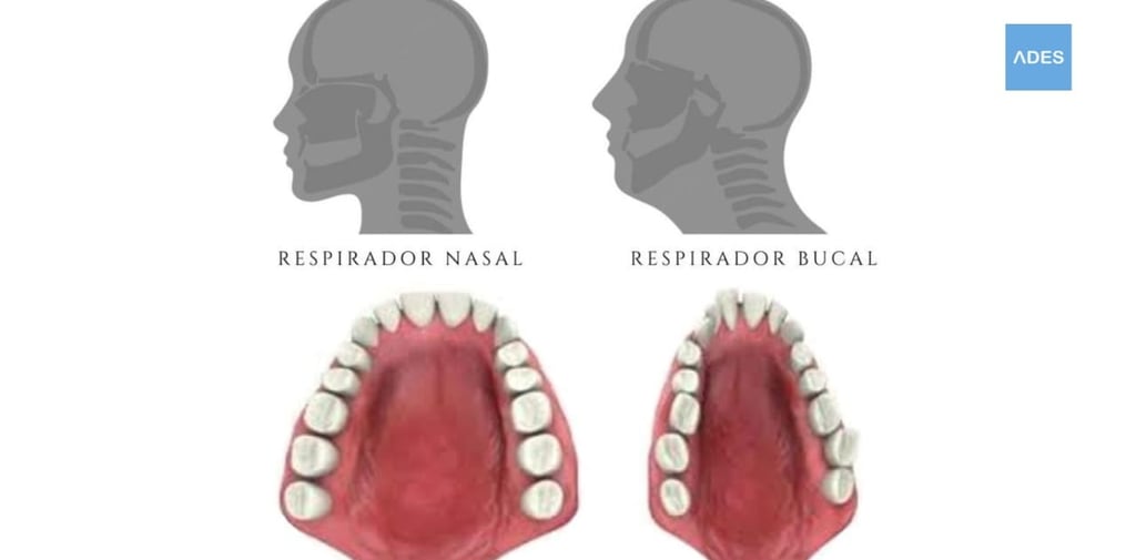 ortodoncia respiracion