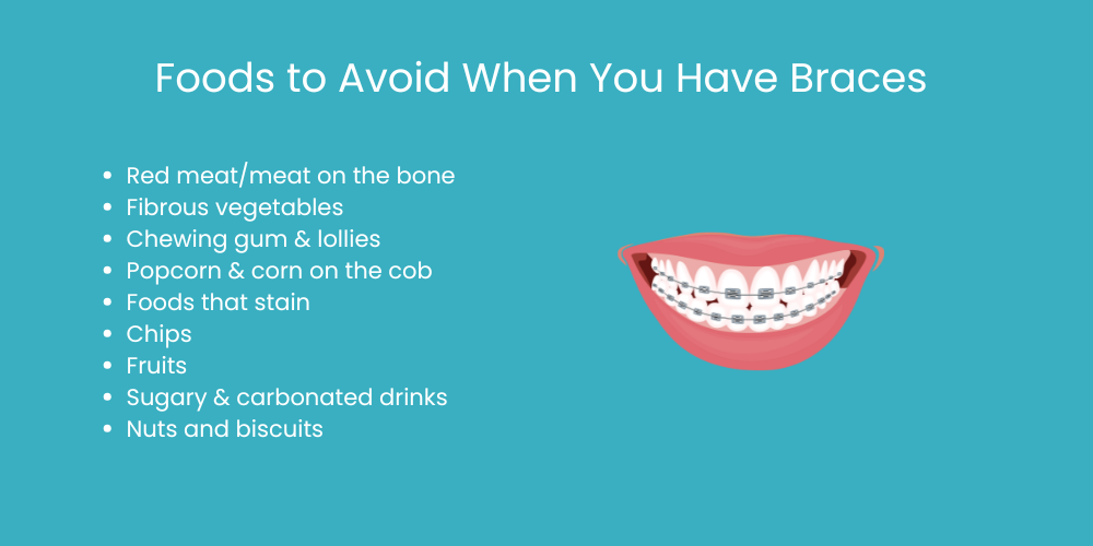 foods to avoid when you have braces