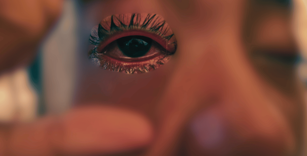 Corneal Abrasion due to contact lenses