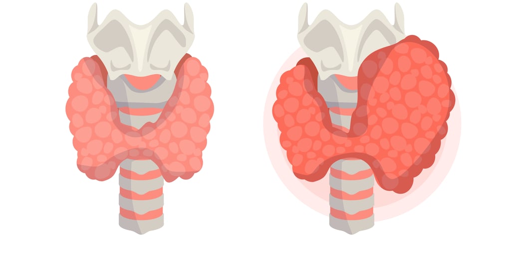 a diagram of the human organs of the stomach