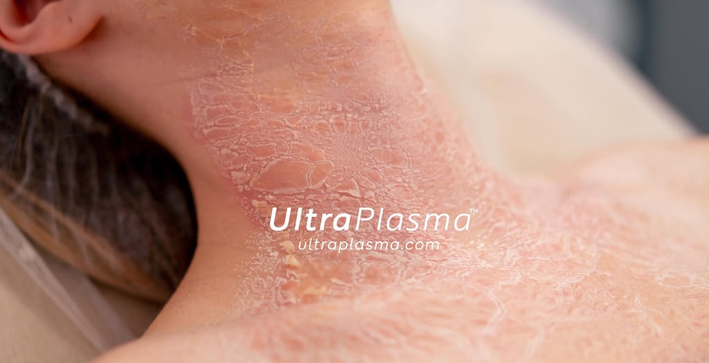 _ultra_plasma_ultra_plazma_ultra-plasma_ultra-plazma