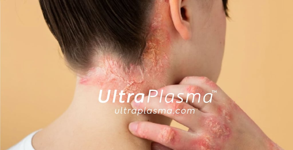 _ultra_plasma_ultra_plazma_ultra-plasma_ultra-plazma