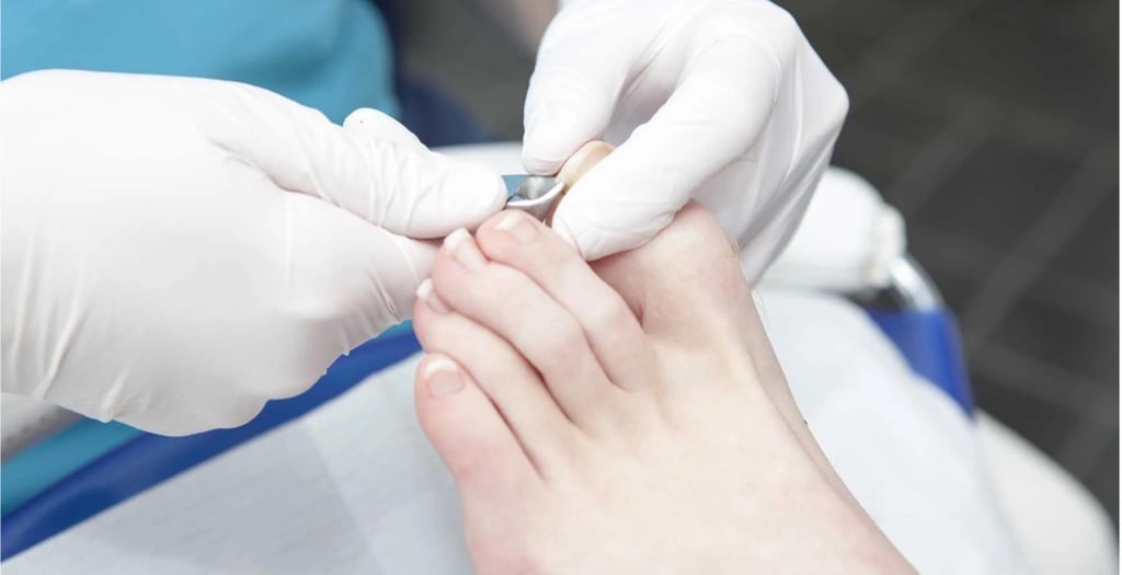 Layanan Kuku Cantengan Klinik Sehat Plus BSD