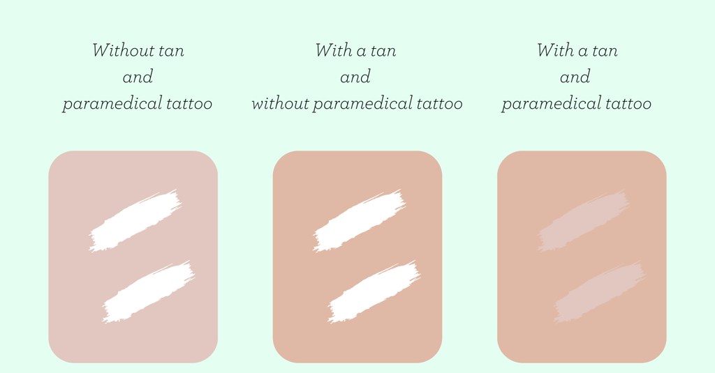 tanning with paramedical tattoo