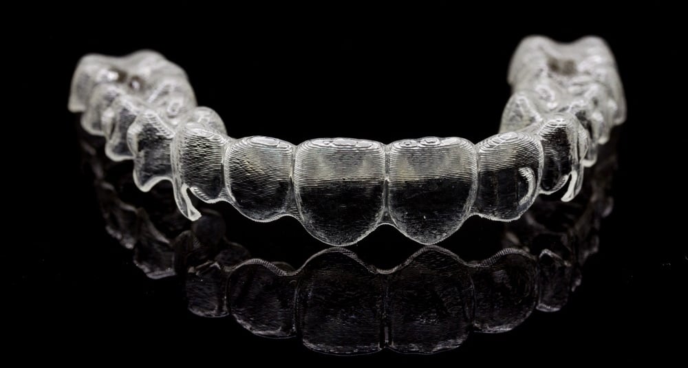 niềng răng trong suốt