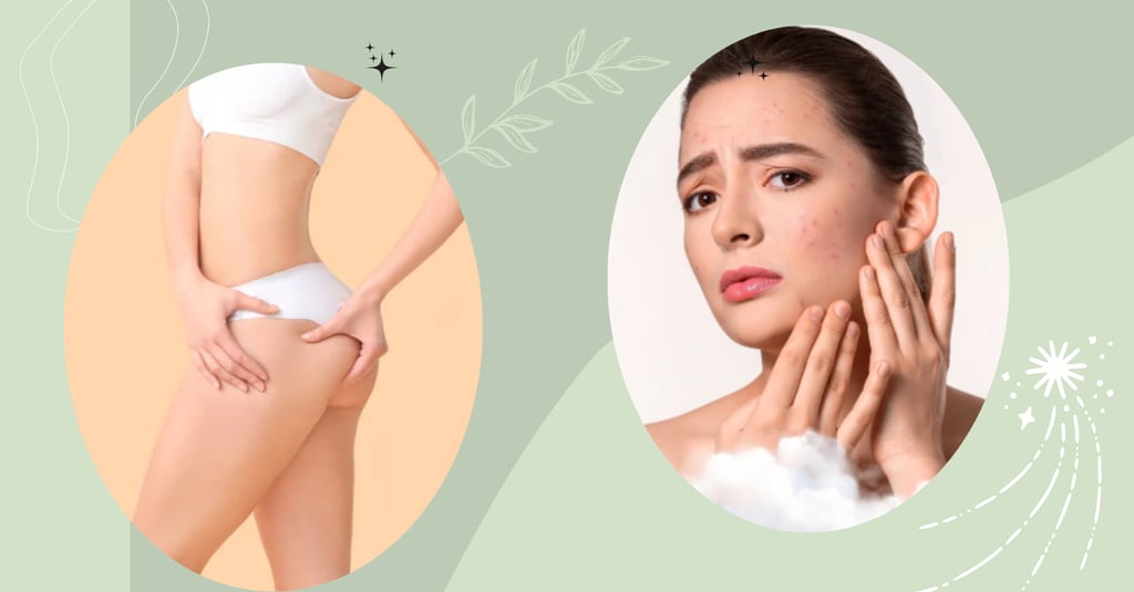A woman treating facial acne and another showing smooth body skin after skincare.