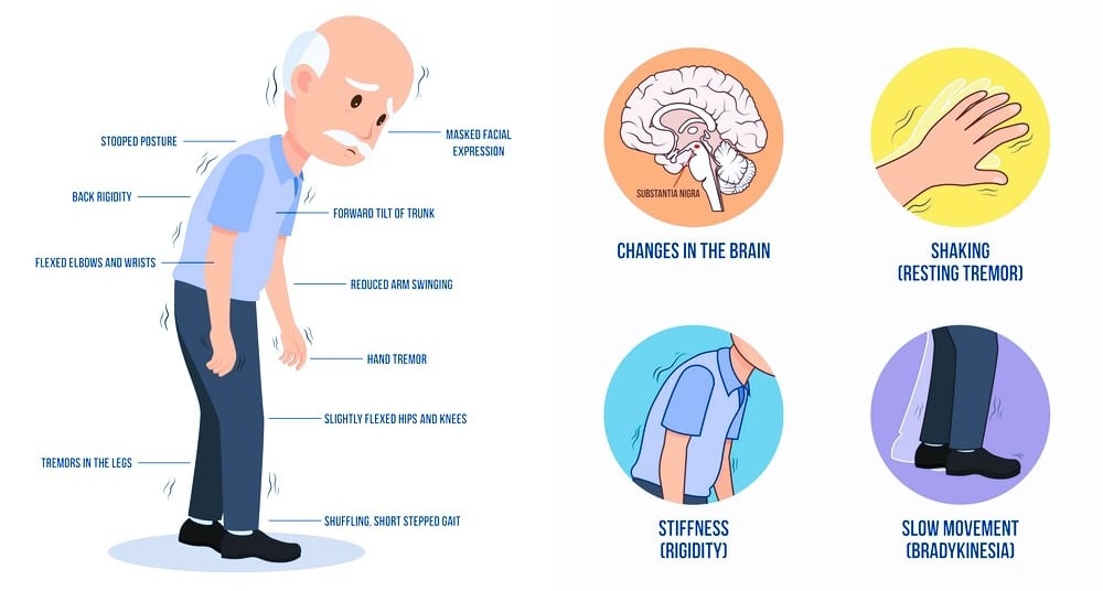 Parkinsons Disease
