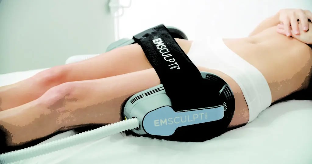 Dispositivo de tonificación muscular Emsculpt colocado sobre el muslo del paciente.