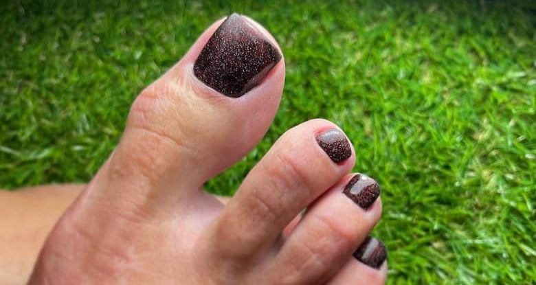 Podologas atliko aparatinį pedikiūrą ir pašalino nuospaudas