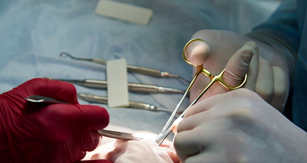 جراحة اسنان الكويت