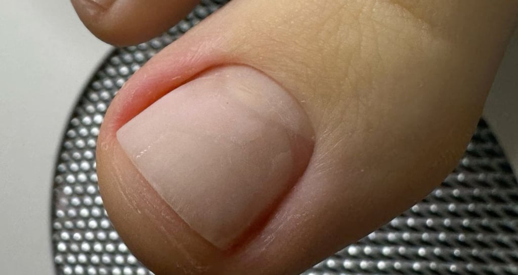 Higieninis pedikiūras