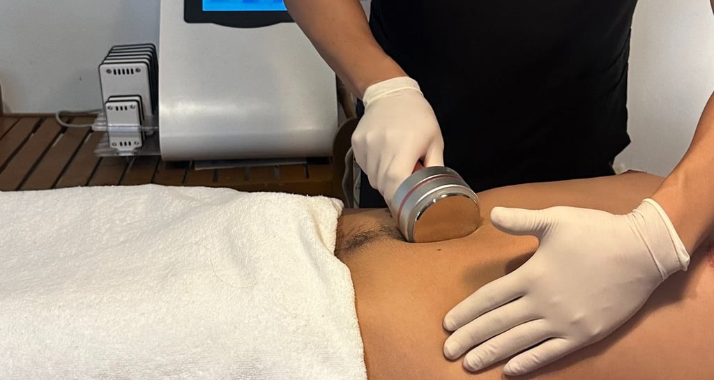 La Cavitación nos ayuda a modelar la figura al movilizar los depósitos de tejido adiposo.