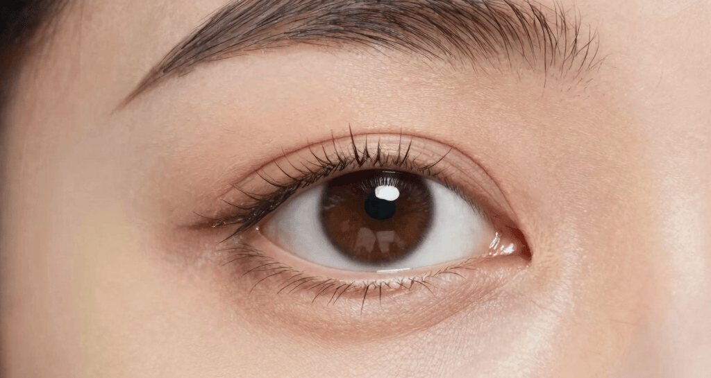 Side profile of the patient after blepharoplasty showing smooth eyelid contour