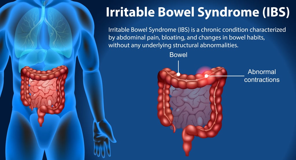 GASTRO FOUNDATION irritable bowel syndrome