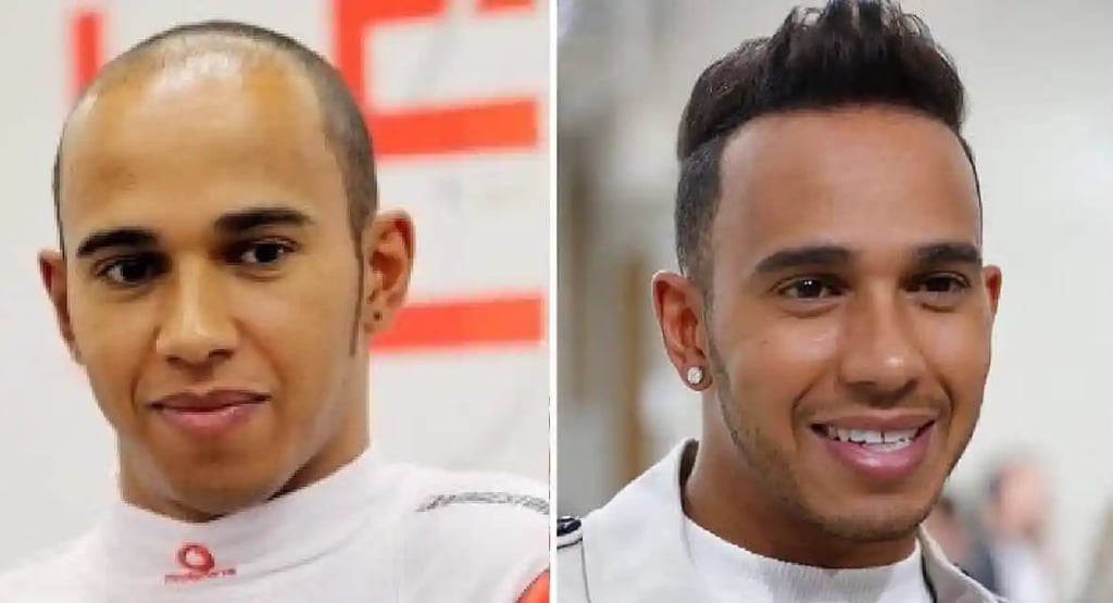 Lewis Hamilton's Hair Transformation