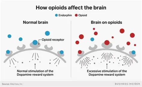 A visual comparion between the normal human brain and brain on opiods