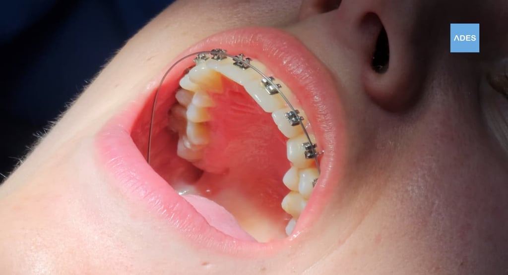 brackets metalicos badajoz