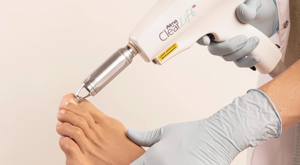 onicomicosis