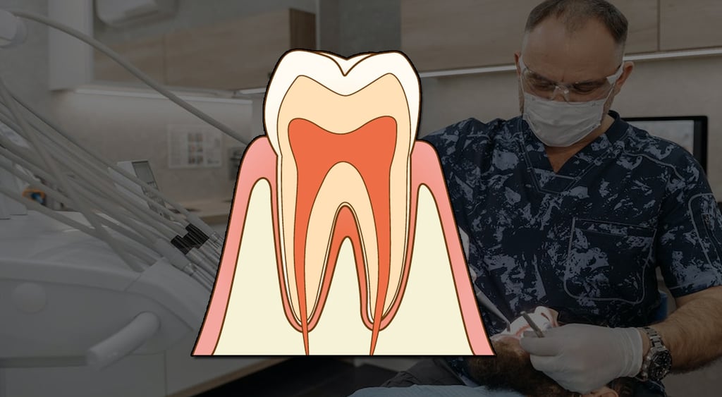 agressão ao complexo dentinopulpar resumo concurso público de odontologia dentista