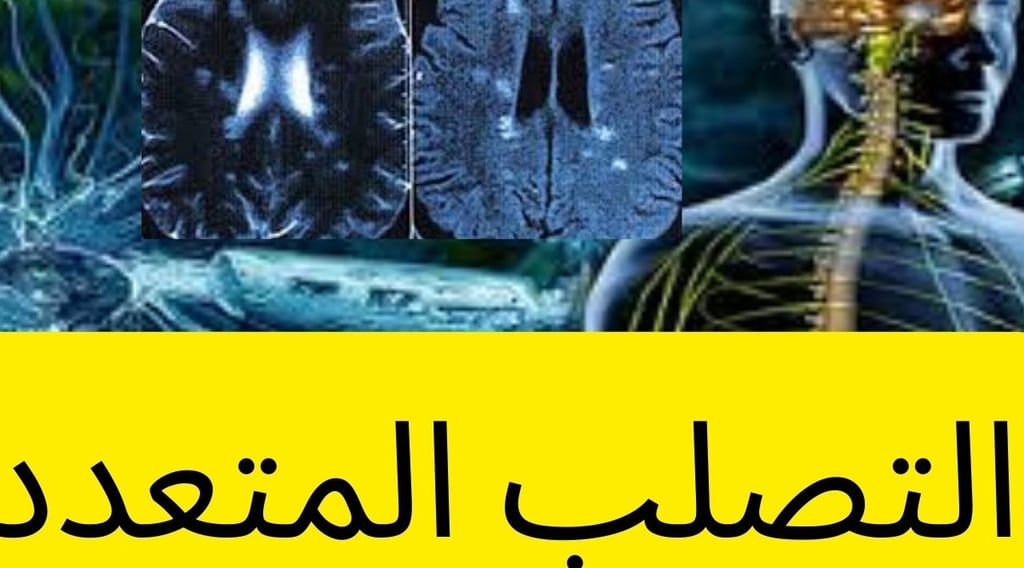 التصلب المتعدد