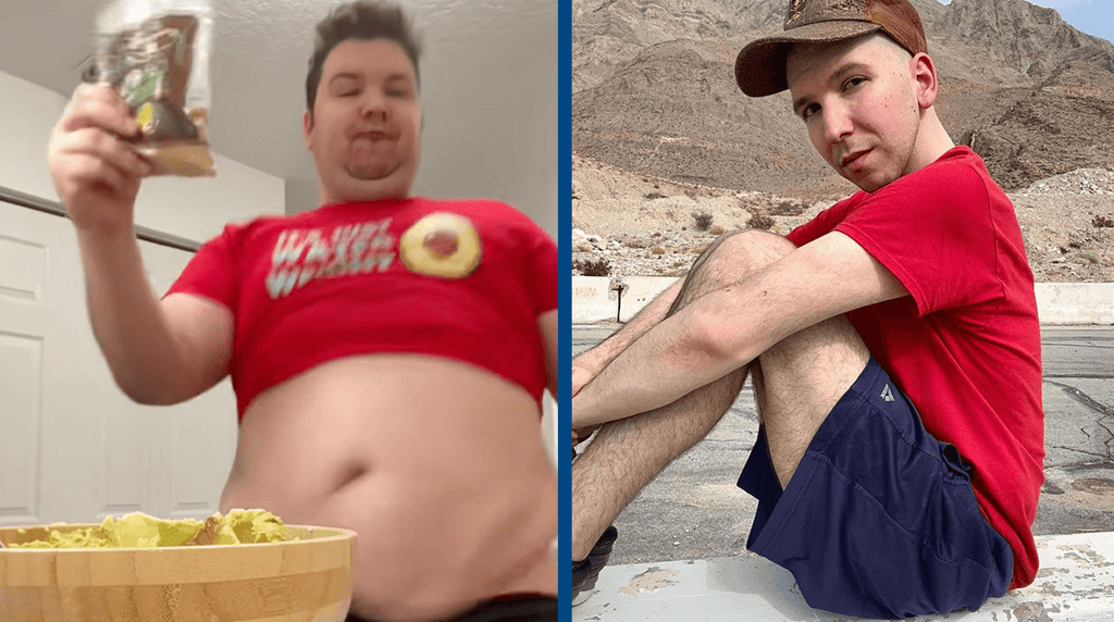 Nikocado Avocado before and after surgery