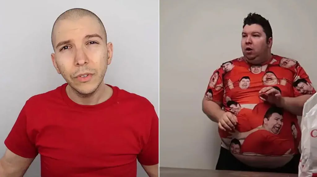 Nikocado Avocado before and after surgery