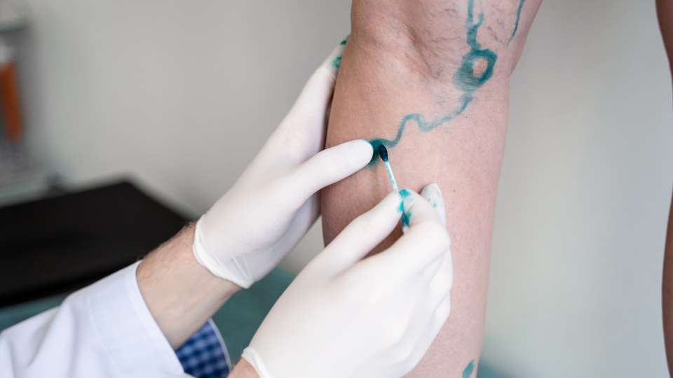 Vascular Surgery at Bone Care One Day Surgery Center in Abu Dhabi