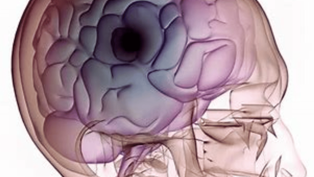 brain