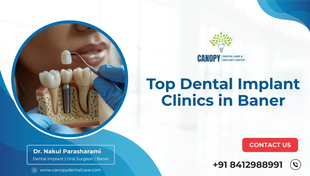 Top Dental Implant Clinics in Baner
