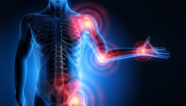 Understanding inflammation