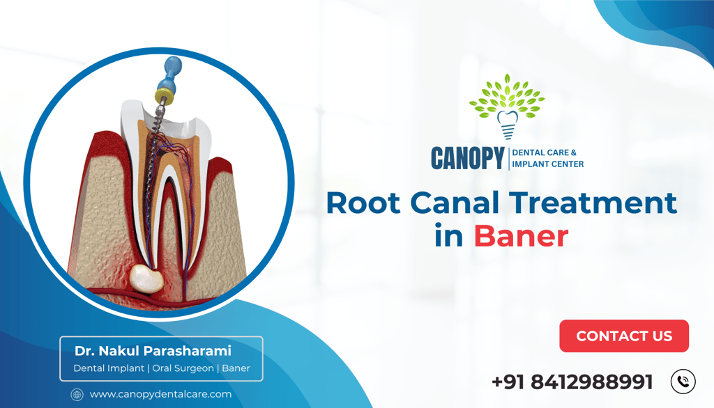 Root Canal Treatment in Baner