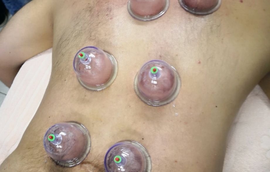 رقم افضل حجامة في جدة