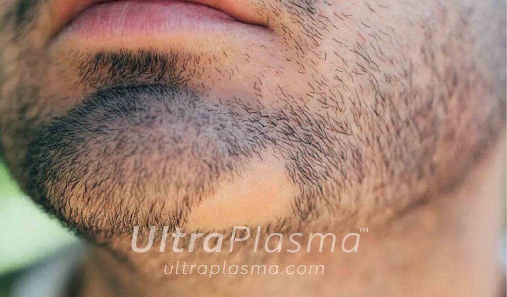 _ultra_plasma_ultra_plazma_ultra-plasma_ultra-plazma