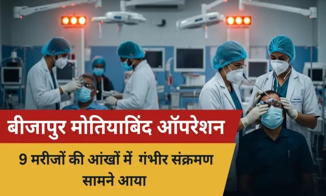 छत्तीसगढ़ में मोतियाबिंद ऑपरेशन के बाद 9 मरीजों की आंखें संक्रमित, मेकाहारा में भर्ती