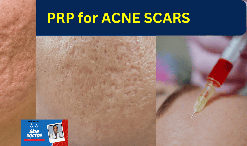 WATCH VIDEO : WATCH THE PROCEDURE BEING DONE click here now : https://youtu.be/_oEMEnPGVoo