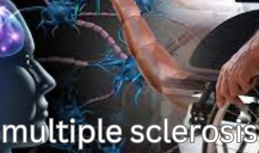 multiple sclerosis