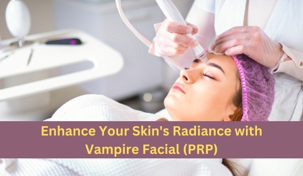 Vampire Facial (PRP)