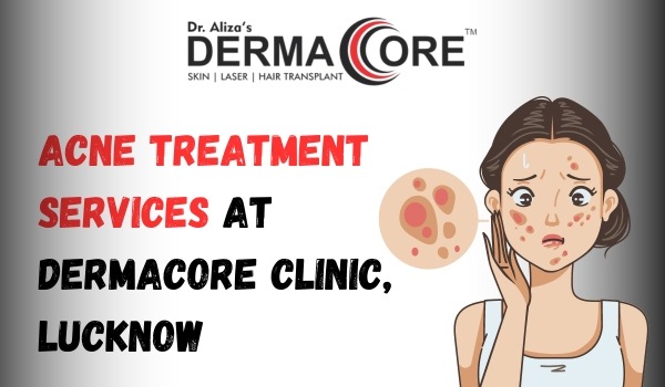 acne treatment dermacore lucknow
