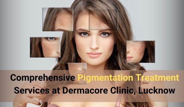 pigmentation treatment