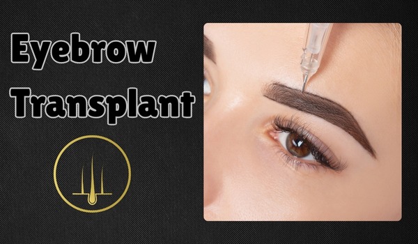 Eyebrow Transplant