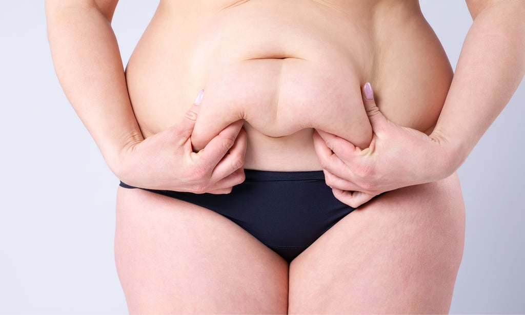 Will HIFU get rid of my Mummy Tummy?