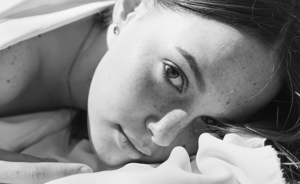 melasma piel hiperpigmentación clínica murcia estética eliminación peeling láser dermatologia murcia