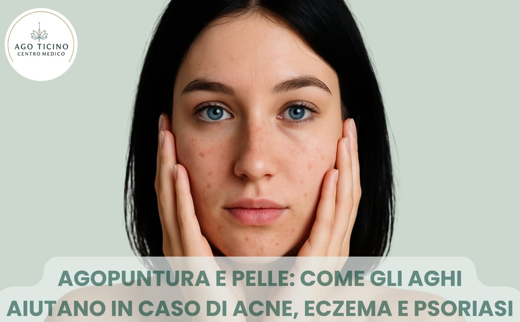 agopuntura-acne-eczema-orticaria-psoriasi-prurito-giubiasco