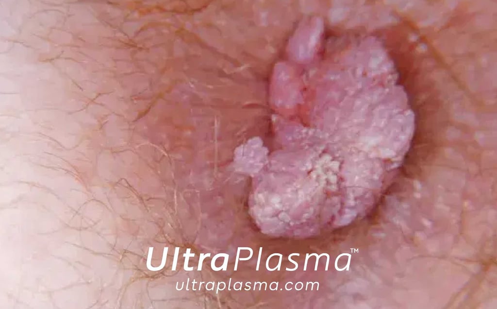 _ultra_plasma_ultra_plazma_ultra-plasma_ultra-plazma