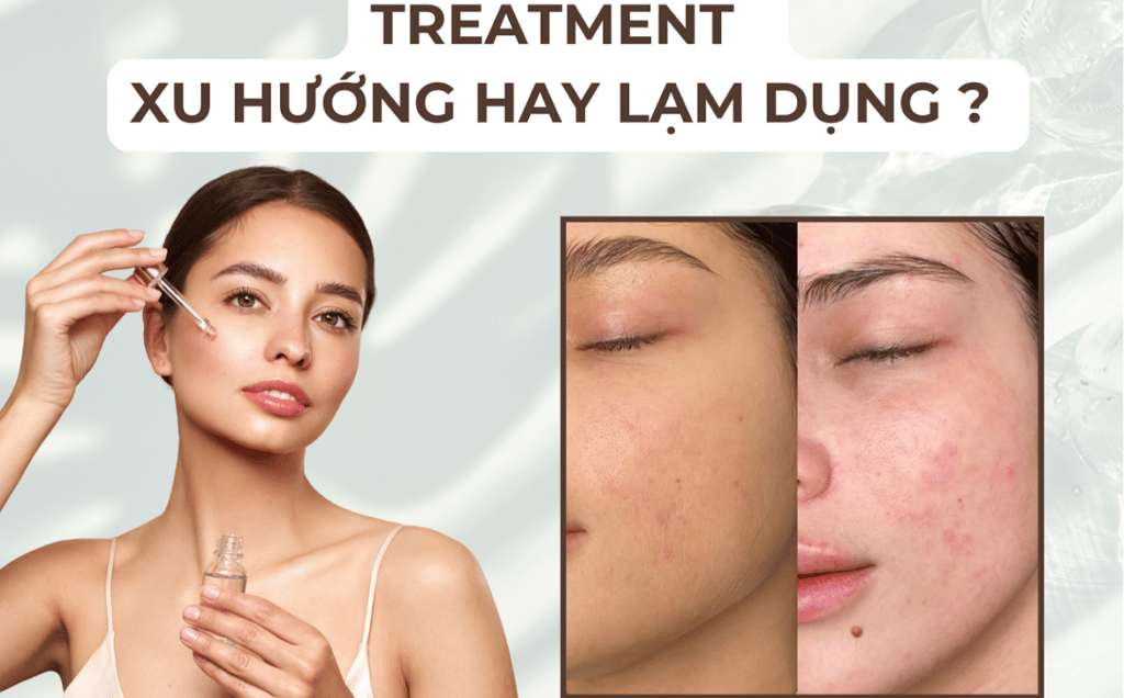 Treatment - Xu hướng hay lạm dụng
