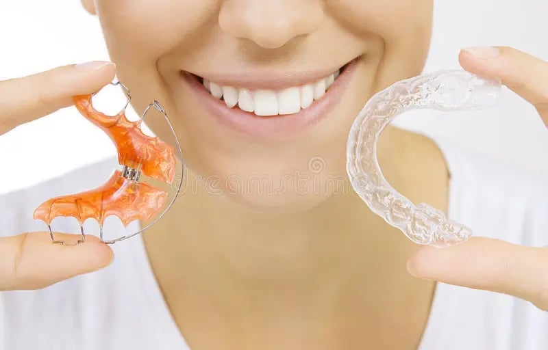 Retainer gigi di Sidharta Dental Studio Malang untuk menjaga hasil perawatan ortodonti