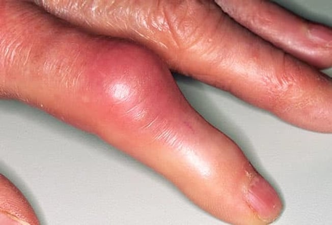 a person with a finger on a computer