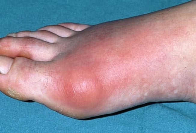 a person with a foot on a bed