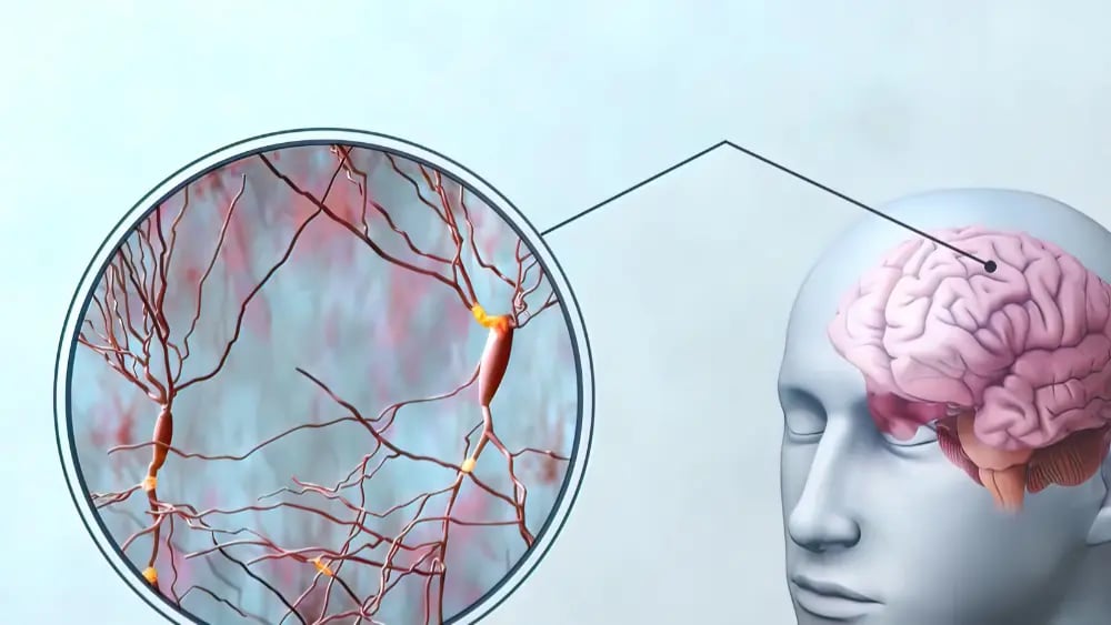 A deep enlargement of synapsises in the human brain