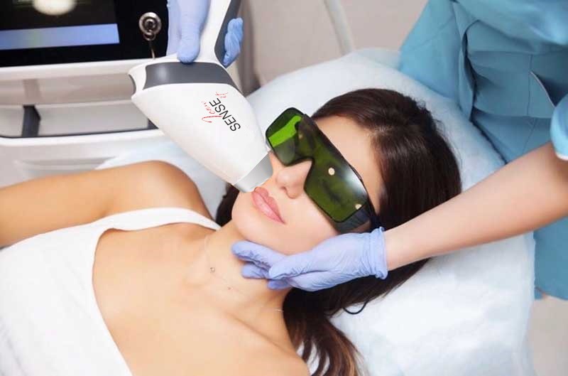 Epilazione laser al diodo viso a Riccione eseguita in centro estetico con trattamento professionale